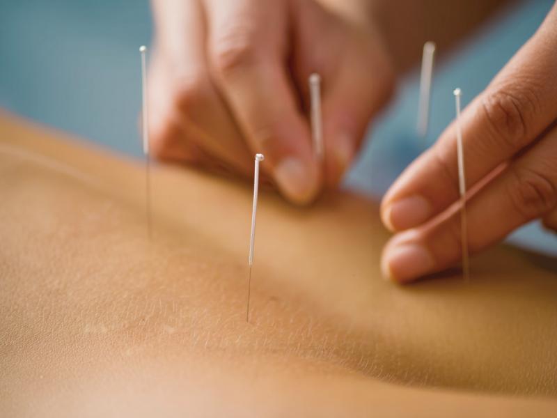 ACUPUNCTURE TIME